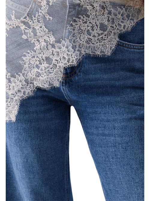 BANDANA PIZZO LIU JO | CF6179-D508277097